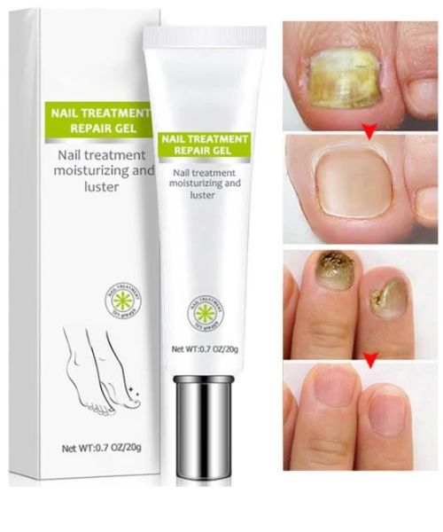 Nail Addict Nail 7 Tage Behandlung Gel