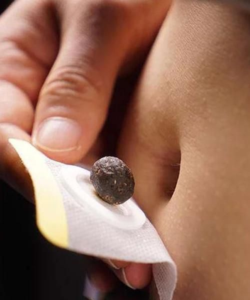 TummyLab Schlankheits-Bauchpellet