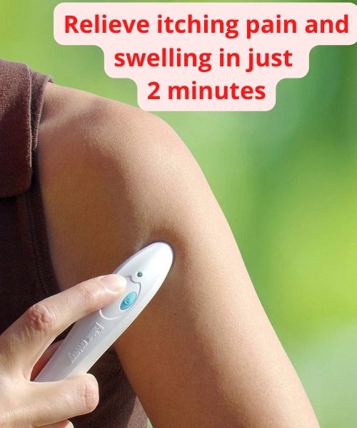 Bte away - Linderung von Insektenstichen und -bissen